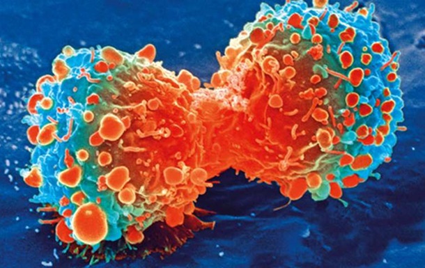 Ученые нашли способ остановить разрушение иммунной системы раком