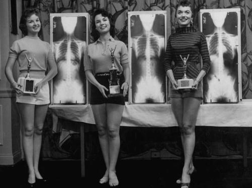Мисс идеальная осанка - 1956 год В этом конкурсе оценивалась не внешность конкурсанток, а их рентгеновские снимки. Модели Марианна Баба, Луис Конвей и Рут Свенсен стоят возле своих рентгеновских фото, которые принесли им призовые места.