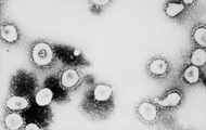 Что ученые узнали о коронавирусе к этому времени