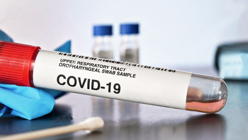 Более 120 случаев коронавируса выявили в Подмосковье за сутки
