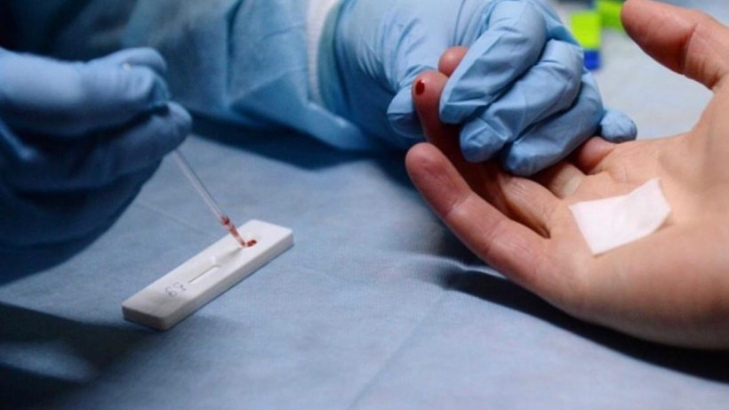 Более 250 тыс. человек прошли тестирование на ВИЧ в Подмосковье с начала года