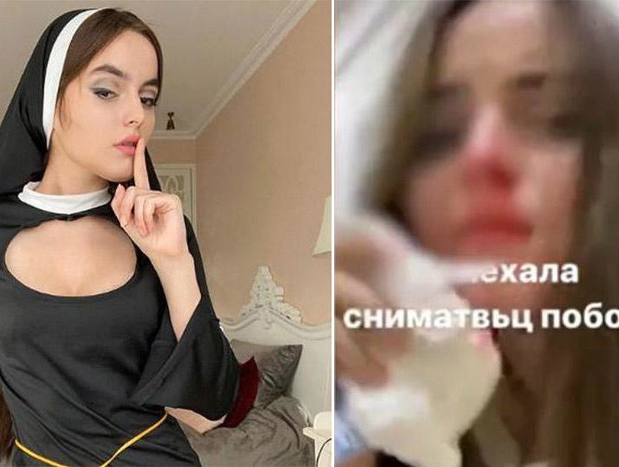 Звезде Tik-Tok разбили лицо за откровенные танцы в наряде монашки