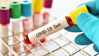 Порядка 690 случаев коронавируса выявили в Подмосковье за сутки