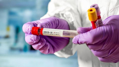 Еще 2 444 случая заболевания коронавирусом выявили в Московской области