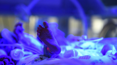 Более 650 недоношенных детей спасли врачи в Подмосковье за 10 месяцев