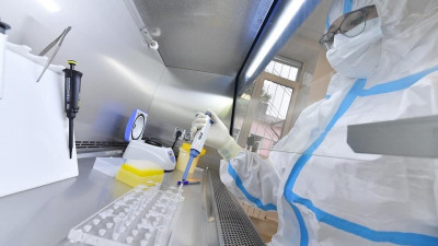 Более 1,1 тыс. новых случаев коронавируса выявили в Московской области